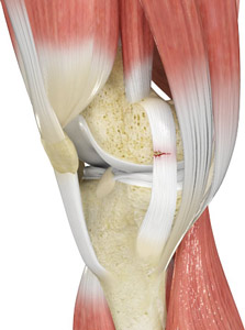  Ligament Injuries   